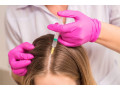 choose-the-best-hair-treatment-skin-care-clinic-in-bhubaneswar-small-0