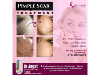 Trusted Pimple Scar Treatment Clinic in Acharya Vihar, Bhubaneswar