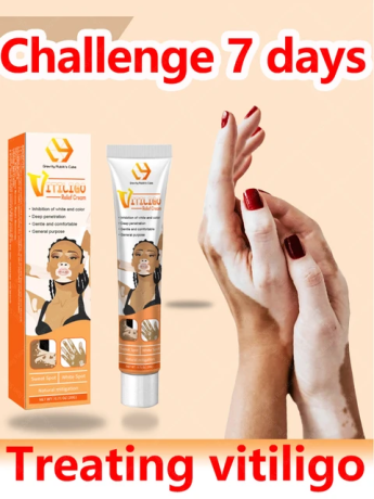 vitiligo-ointment-remove-ringworm-ship-mart-white-spot-removal03208727951-big-0