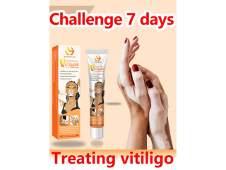 Vitiligo Ointment Remove Ringworm, Ship Mart, 03000479274