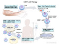 overview-of-car-t-cell-therapy-for-cancer-treatment-small-0