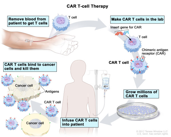 overview-of-car-t-cell-therapy-for-cancer-treatment-big-0