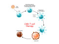 car-t-cell-therapy-process-a-guide-to-cancer-treatment-cyprus-small-0