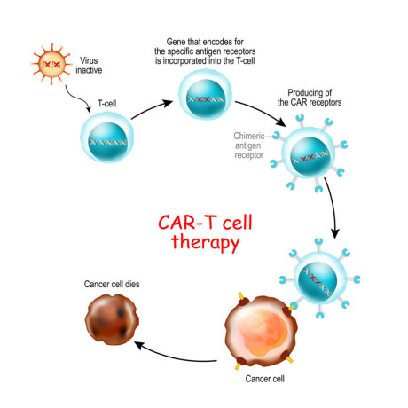 car-t-cell-therapy-process-a-guide-to-cancer-treatment-cyprus-big-0