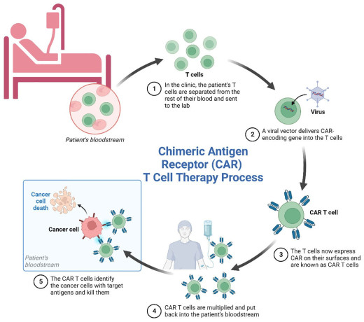 exploring-the-role-of-car-t-cell-therapy-in-treating-blood-cancers-big-0