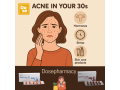 isotretinoin-severe-acne-treatment-small-0