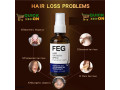 feg-hair-growth-spray-price-in-naudero-03001819306-small-0