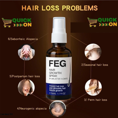feg-hair-growth-spray-price-in-kashmor-03001819306-big-0