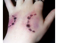 dog-bite-accident-lawyer-palm-springs-small-0