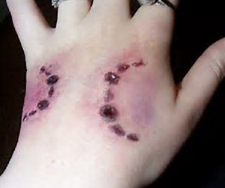 dog-bite-accident-lawyer-palm-springs-big-0