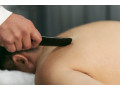 acupuncture-wicker-park-small-0